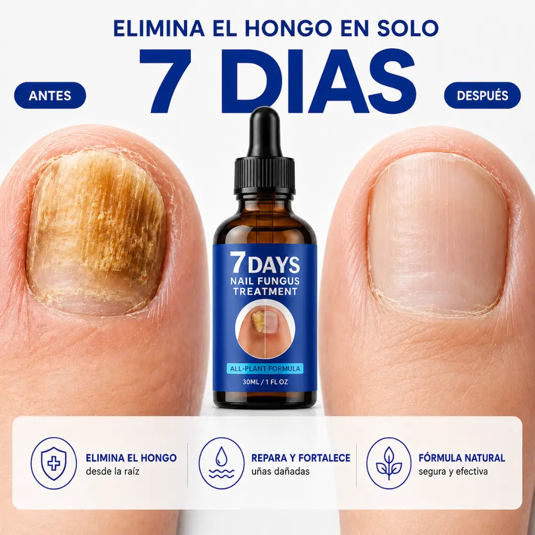 Tratamiento para Uñas con Hongos