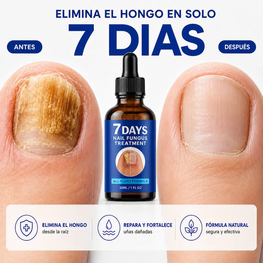 Tratamiento para Uñas con Hongos